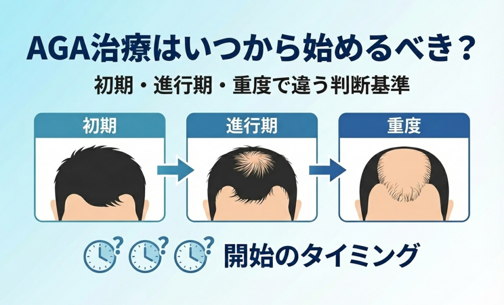 AGA治療を始めるタイミングの判断基準を解説するイメージ